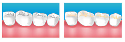 Soins dentaires centre dentaire colomiers